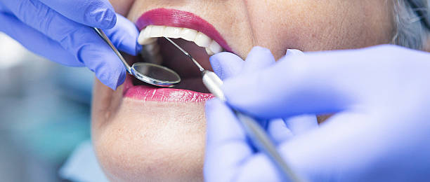 Best Emergency Cosmetic Dentistry (e.g., broken veneers) in Littleton, CO